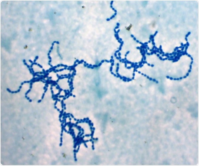 Bacterial cells chains 'Streptococcus pyogenes' (Photo from microscope, magnification x 1000). This rare strain have strong anticancer and immunostimulating activity and non-pathogenic. Image Credit: Dimarion / Shutterstock